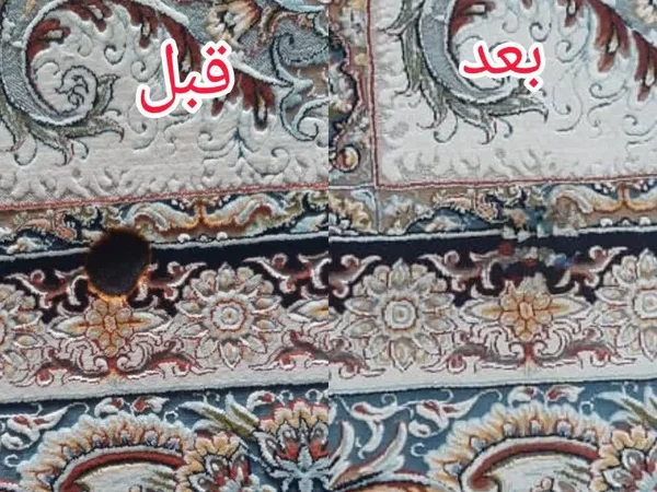 رفع سوختگی در قالیشویی ایرانیان